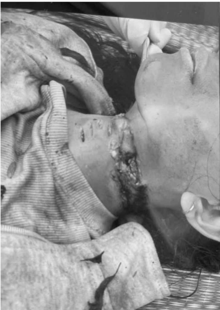 Hiện trường vụ việc